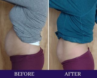 Side-by-side comparison of a person's abdomen before and after showing reduced belly size.