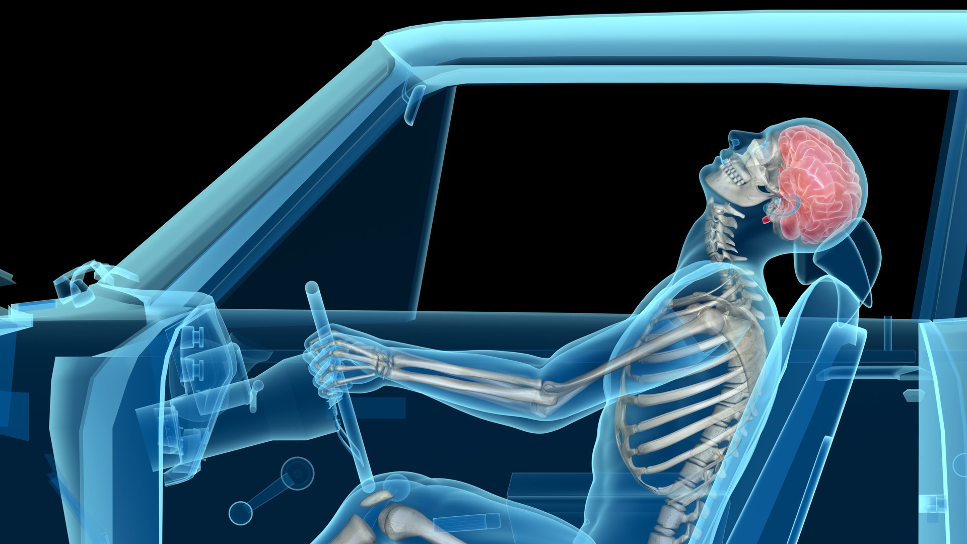 Human anatomy in a car crash, bones and brain